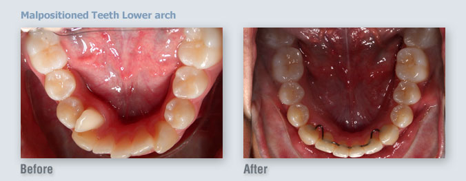 ortho_before-after18_1333508126