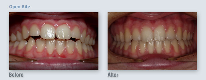 ortho_before-after19_1333508128