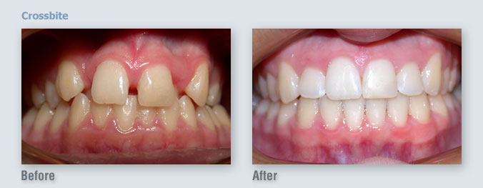 ortho_before-after15_1333508122